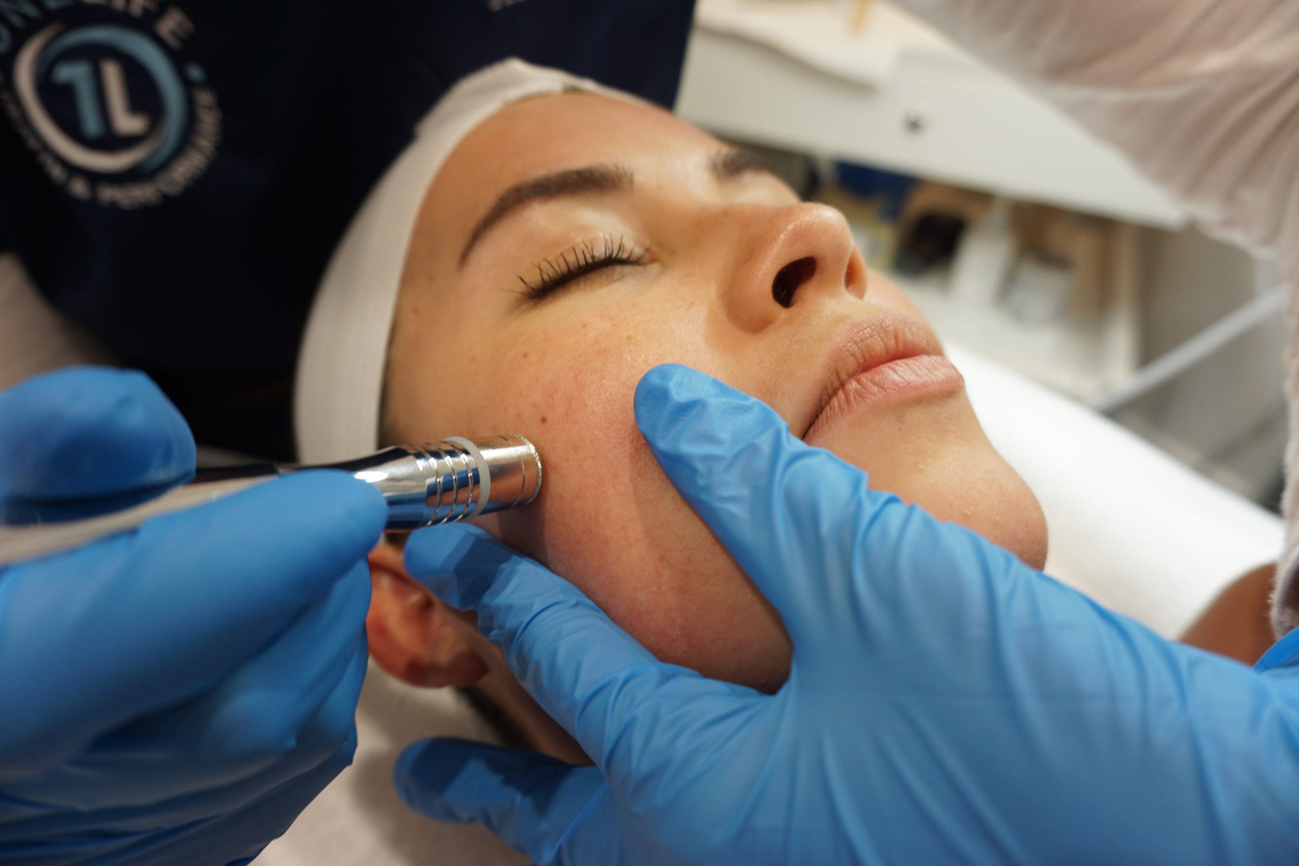 Microdermabrasion for women